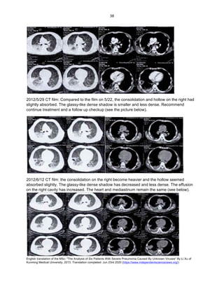 English translation of the MSc: "The Analysis of Six Patients With Severe Pneumonia Caused By Unknown Viruses" By Li Xu of
Kunming Medical University, 2013. Translation completed: Jun 23rd 2020 (https://www.independentsciencenews.org/)
	
	
38	
2012/5/29 CT film: Compared to the film on 5/22, the consolidation and hollow on the right had
slightly absorbed. The glassy-like dense shadow is smaller and less dense. Recommend
continue treatment and a follow up checkup (see the picture below).
2012/6/12 CT film: the consolidation on the right become heavier and the hollow seemed
absorbed slightly. The glassy-like dense shadow has decreased and less dense. The effusion
on the right cavity has increased. The heart and mediastinum remain the same (see below).
 