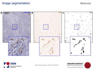 Jakob Nikolas Kather I Slide 6 I 8/22/2015
Image segmentation Methods
 