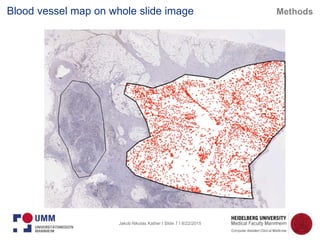 Jakob Nikolas Kather I Slide 7 I 8/22/2015
Blood vessel map on whole slide image Methods
 