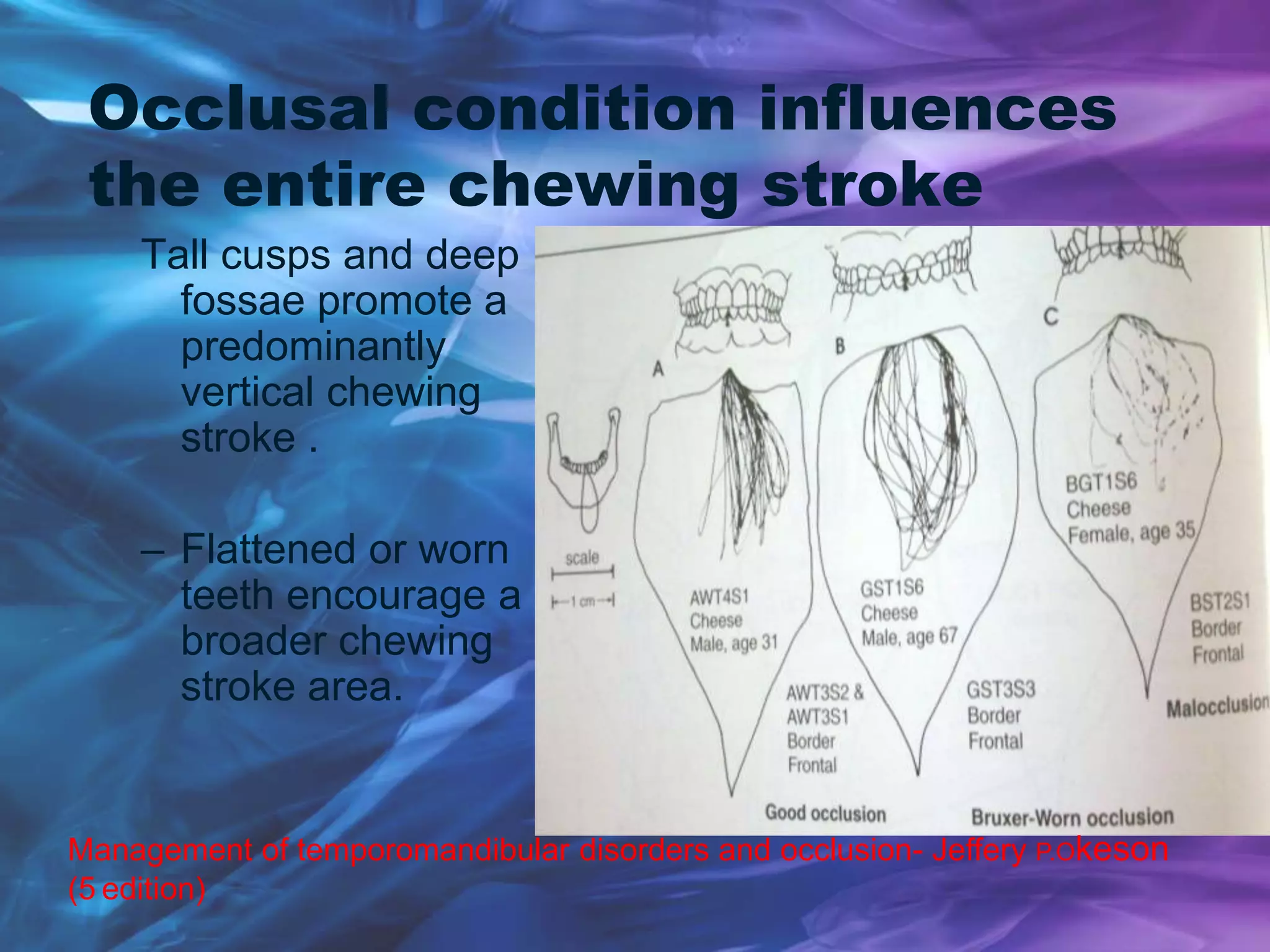 Occlusal condition influences
the entire chewing stroke
Tall cusps and deep
fossae promote a
predominantly
vertical chewing
stroke .
– Flattened or worn
teeth encourage a
broader chewing
stroke area.
Management of temporomandibular disorders and occlusion- Jeffery P.Okeson
(5 edition)
 