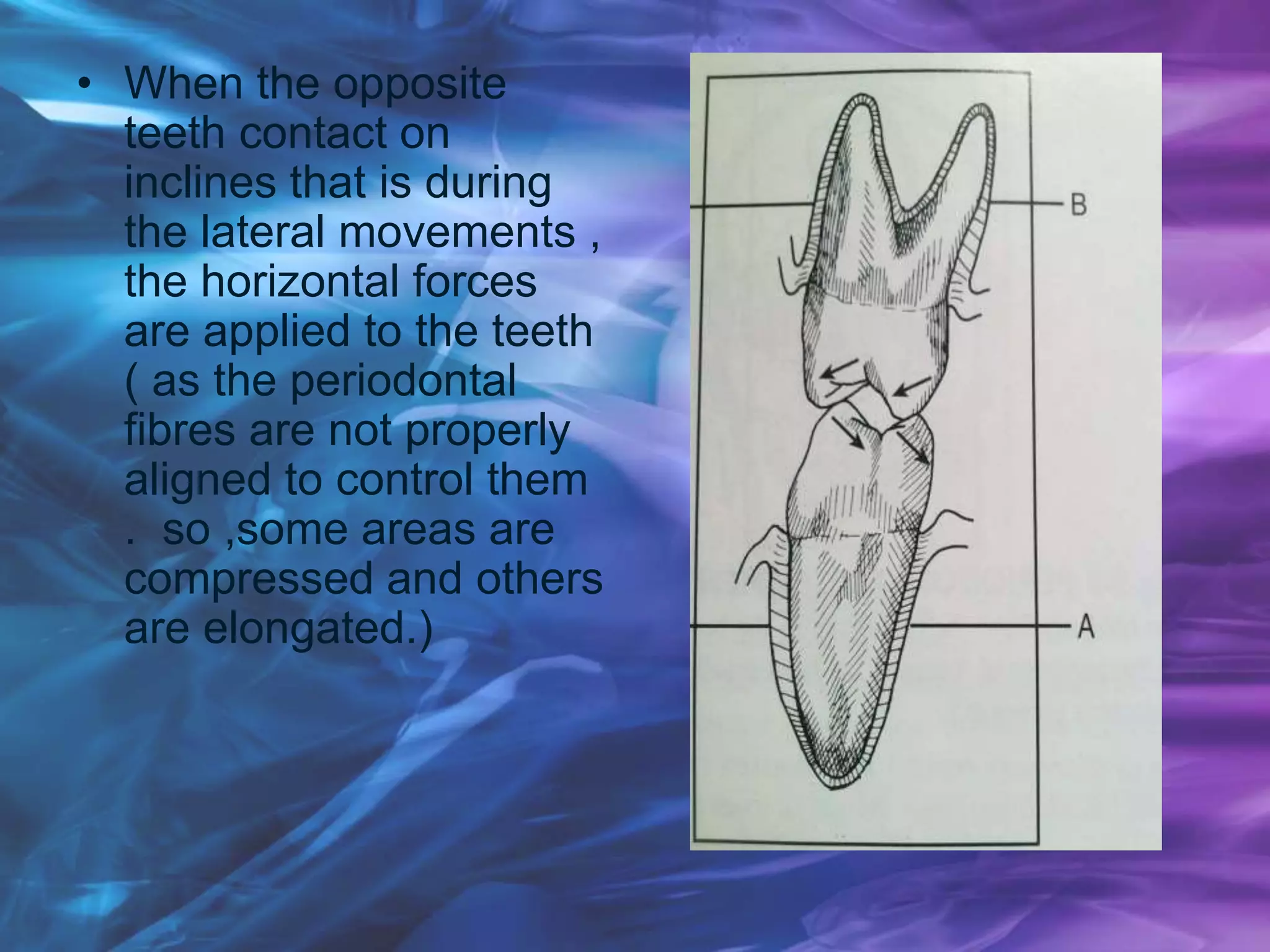 • When the opposite
teeth contact on
inclines that is during
the lateral movements ,
the horizontal forces
are applied to the teeth
( as the periodontal
fibres are not properly
aligned to control them
. so ,some areas are
compressed and others
are elongated.)
 