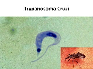 Trypanosoma Cruzi 
 
