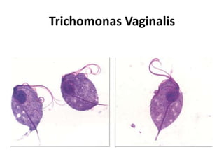 Trichomonas Vaginalis 
 