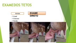 EXAMEDOS TETOS
TETOS
 Canal
 Cisternas
 Parede
EXAME
DIRETO
 