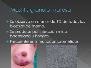 Mastitis granulo matosaSe observa en menos de 1% de todas las biopsias de mama.Se produce por infección mico bacteriana u hongos.Frecuente en inmunocomprometidos.