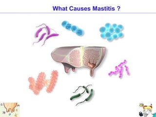 What Causes Mastitis ?
 