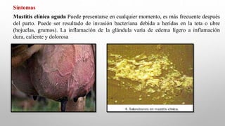 Síntomas
Mastitis clínica aguda Puede presentarse en cualquier momento, es más frecuente después
del parto. Puede ser resultado de invasión bacteriana debida a heridas en la teta o ubre
(hojuelas, grumos). La inflamación de la glándula varía de edema ligero a inflamación
dura, caliente y dolorosa
 
