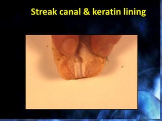 Streak canal & keratin lining
 