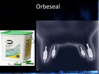 Orbeseal
 
