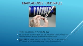 MARCADORES TUMORALES
 Niveles elevados de AFP y/o Beta-HCG
 se observan en el 80-85% de los pacientes con tumores no
seminomatosos, aún sin enfermedad metastásica.
 Beta-HCG se eleva en menos del 20% de los seminomas, y
AFP nunca se encuentra elevada en seminomas puros.
 