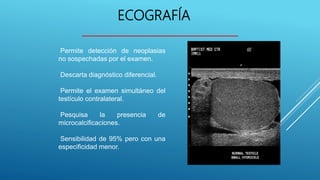 ECOGRAFÍA
Permite detección de neoplasias
no sospechadas por el examen.
Descarta diagnóstico diferencial.
Permite el examen simultáneo del
testículo contralateral.
Pesquisa la presencia de
microcalcificaciones.
Sensibilidad de 95% pero con una
especificidad menor.
 