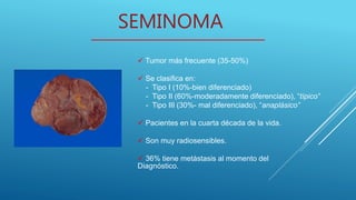 SEMINOMA
 Tumor más frecuente (35-50%)
 Se clasifica en:
- Tipo I (10%-bien diferenciado)
- Tipo II (60%-moderadamente diferenciado), “típico”
- Tipo III (30%- mal diferenciado), “anaplásico”
 Pacientes en la cuarta década de la vida.
 Son muy radiosensibles.
 36% tiene metástasis al momento del
Diagnóstico.
 