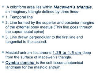 Mastoidectomy | PPT