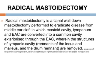 Mastoidectomy | PPT