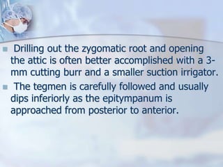  Drilling out the zygomatic root and opening
the attic is often better accomplished with a 3-
mm cutting burr and a smaller suction irrigator.
 The tegmen is carefully followed and usually
dips inferiorly as the epitympanum is
approached from posterior to anterior.
 