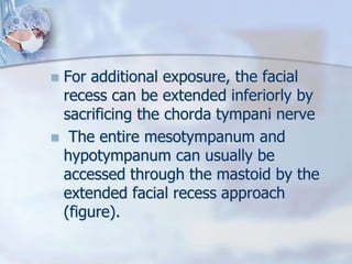  For additional exposure, the facial
recess can be extended inferiorly by
sacrificing the chorda tympani nerve
 The entire mesotympanum and
hypotympanum can usually be
accessed through the mastoid by the
extended facial recess approach
(figure).
 