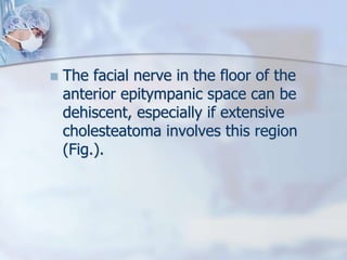  The facial nerve in the floor of the
anterior epitympanic space can be
dehiscent, especially if extensive
cholesteatoma involves this region
(Fig.).
 
