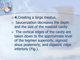  4.Creating a large meatus.
 Saucerization decreases the depth
and the size of the mastoid cavity.
 The cortical edges of the cavity are
taken down to the approximate level
of the tegmen superiorly, sigmoid
sinus posteriorly, and digastric ridge
inferiorly (Fig.).
 