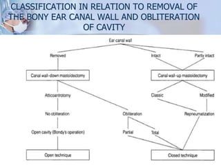CLASSIFICATION IN RELATION TO REMOVAL OF
THE BONY EAR CANAL WALL AND OBLITERATION
OF CAVITY
 