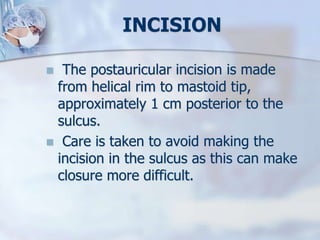INCISION
 The postauricular incision is made
from helical rim to mastoid tip,
approximately 1 cm posterior to the
sulcus.
 Care is taken to avoid making the
incision in the sulcus as this can make
closure more difficult.
 