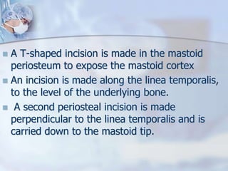  A T-shaped incision is made in the mastoid
periosteum to expose the mastoid cortex
 An incision is made along the linea temporalis,
to the level of the underlying bone.
 A second periosteal incision is made
perpendicular to the linea temporalis and is
carried down to the mastoid tip.
 