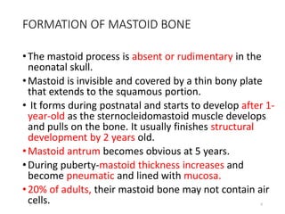 MASTOIDECTOMY PPT | PPT