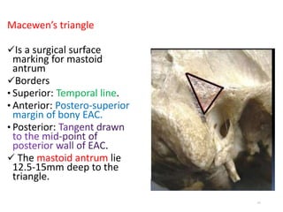 MASTOIDECTOMY (BY DR.RICHARD & DR.BUKUKU) | PPT