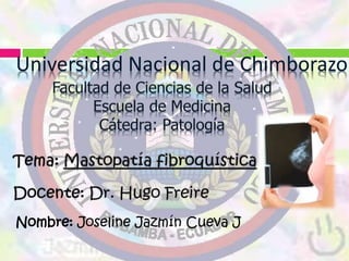 Universidad Nacional de Chimborazo
Nombre: Joseline Jazmín Cueva J
 