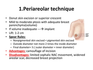 Mastopexy | PPTX