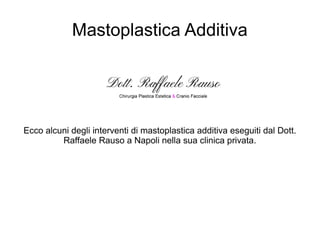 Mastoplastica Additiva 
Ecco alcuni degli interventi di mastoplastica additiva eseguiti dal Dott. 
Raffaele Rauso a Napoli nella sua clinica privata. 
 