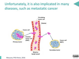 CC BY-SA 4.0
Unfortunately, it is also implicated in many
diseases, such as metastatic cancer
Masuzzo, PhD thesis, 2016
 