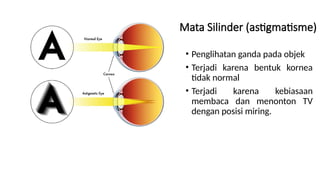 Materi IPAS Bagian-Bagian Mata, penyakit pada mata dan sifat-sifat ...