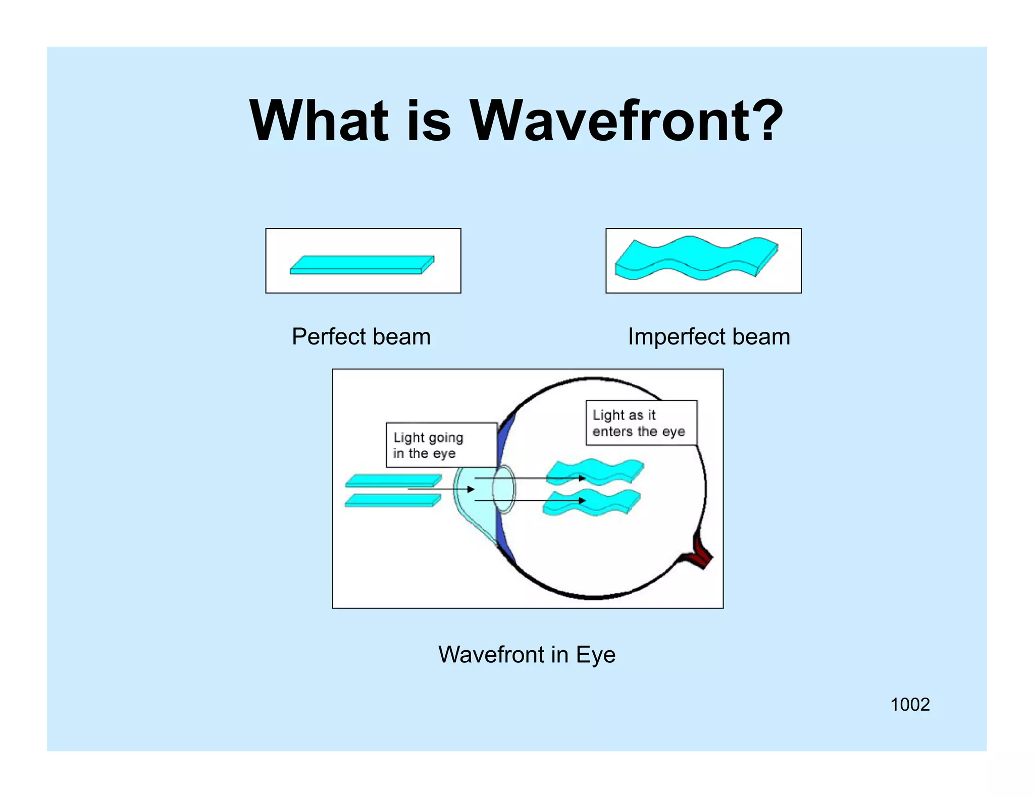 What is Wavefront?

Perfect beam

Imperfect beam
p

Wavefront E e
Wa efront in Eye
1002

 