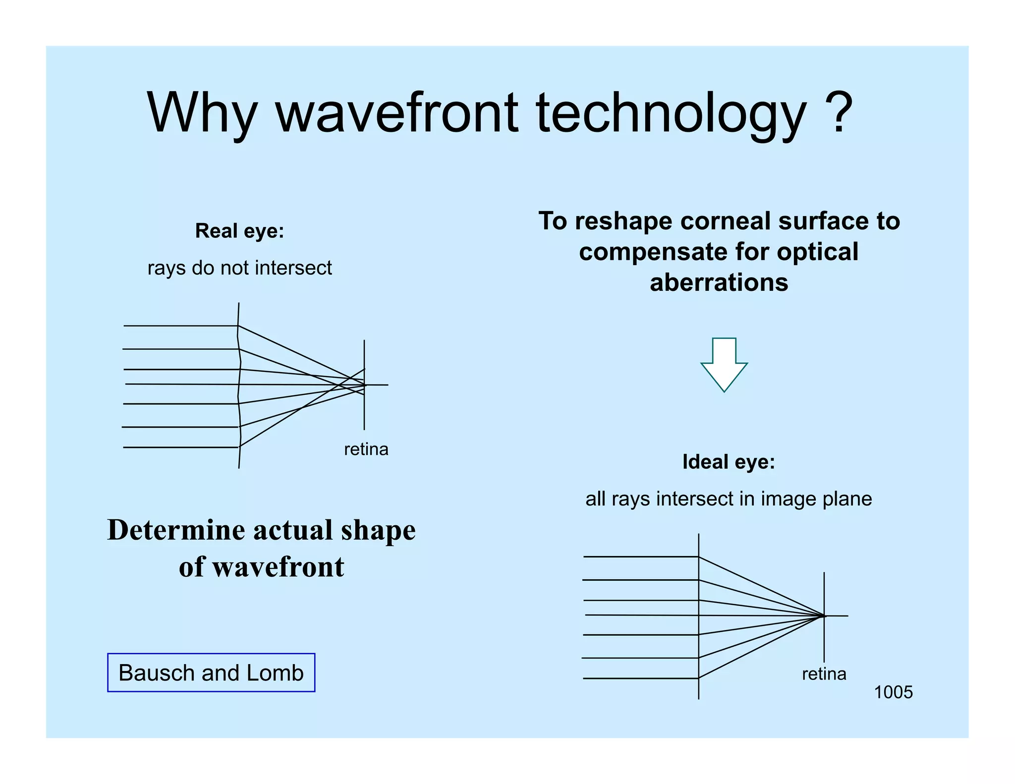 Why wavefront technology ?
To reshape corneal surface to
compensate for optical
t f
ti l
aberrations

Real eye:
rays do not intersect

retina

Ideal eye:
all rays intersect in image plane

Determine actual shape
p
of wavefront
Bausch and Lomb

retina

1005

 