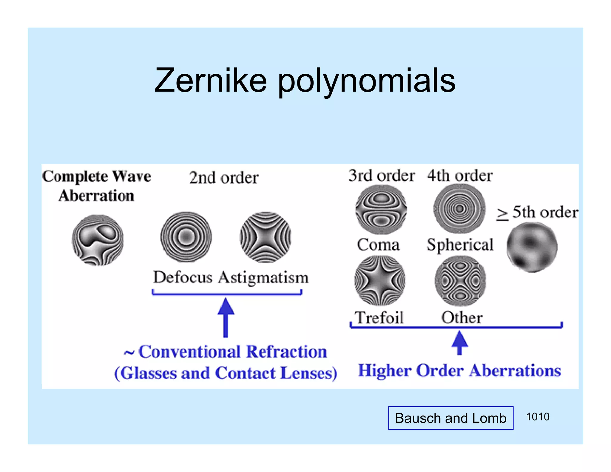 Zernike polynomials

Bausch and Lomb

1010

 