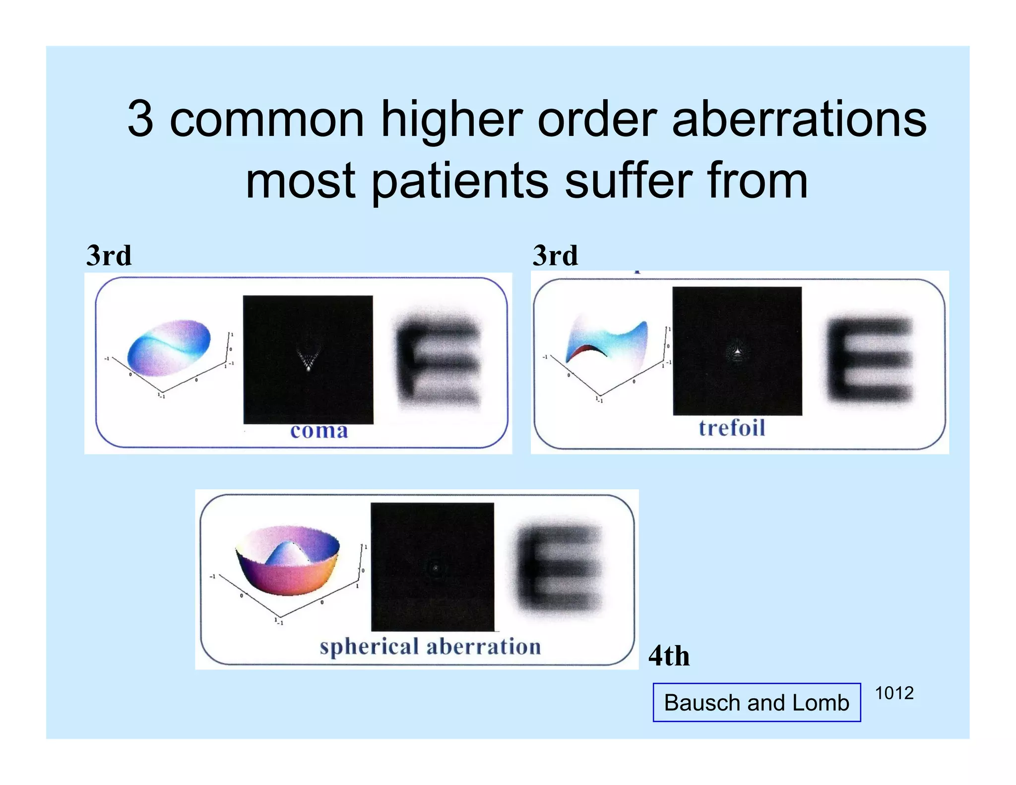 3 common higher order aberrations
g
most patients suffer from
3rd

3rd

4th
Bausch and Lomb

1012

 