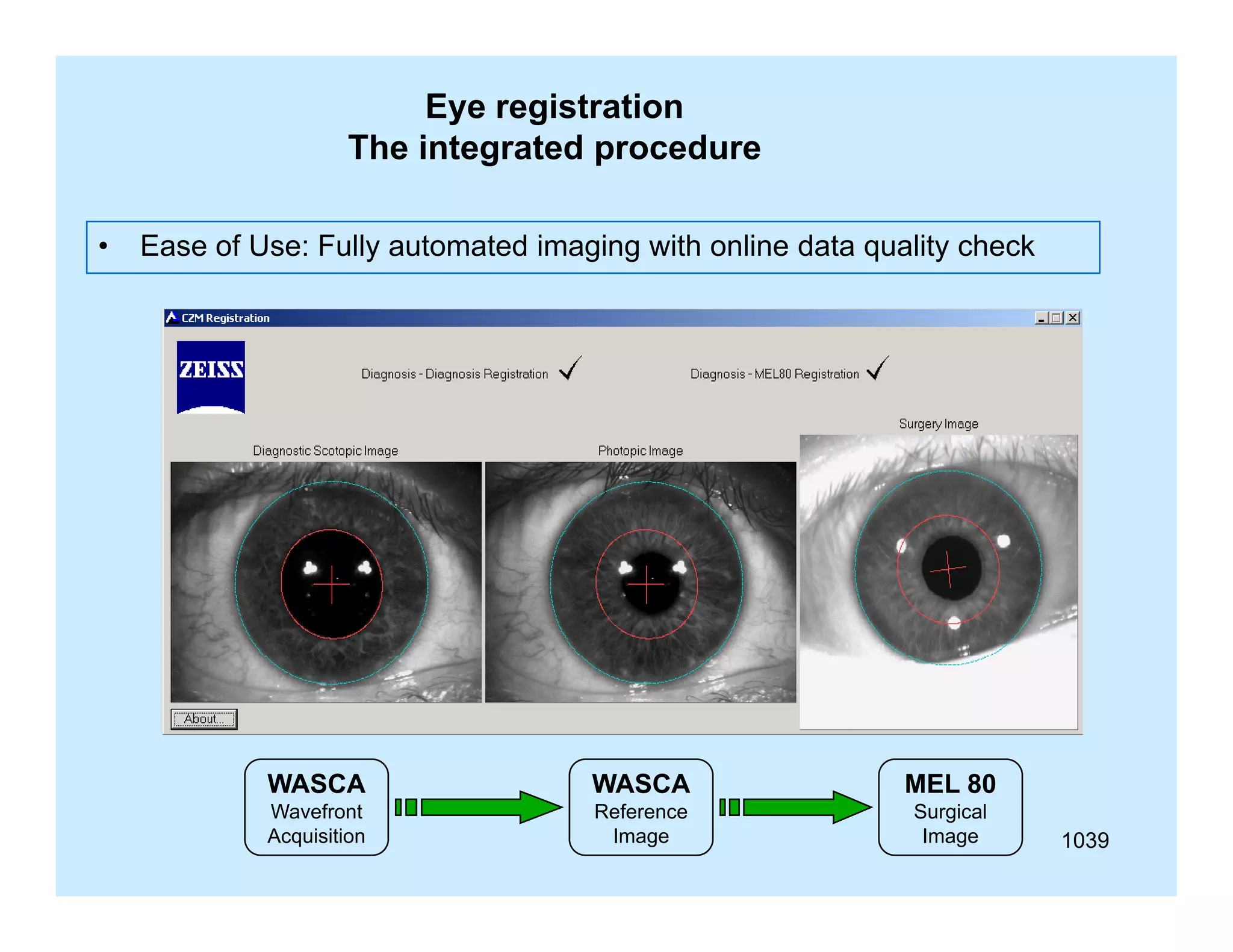 Eye registration
The integrated procedure
•

Ease of Use: Fully automated imaging with online data quality check

WASCA

WASCA

MEL 80

Wavefront
Acquisition

Reference
Image

Surgical
Image

1039

 
