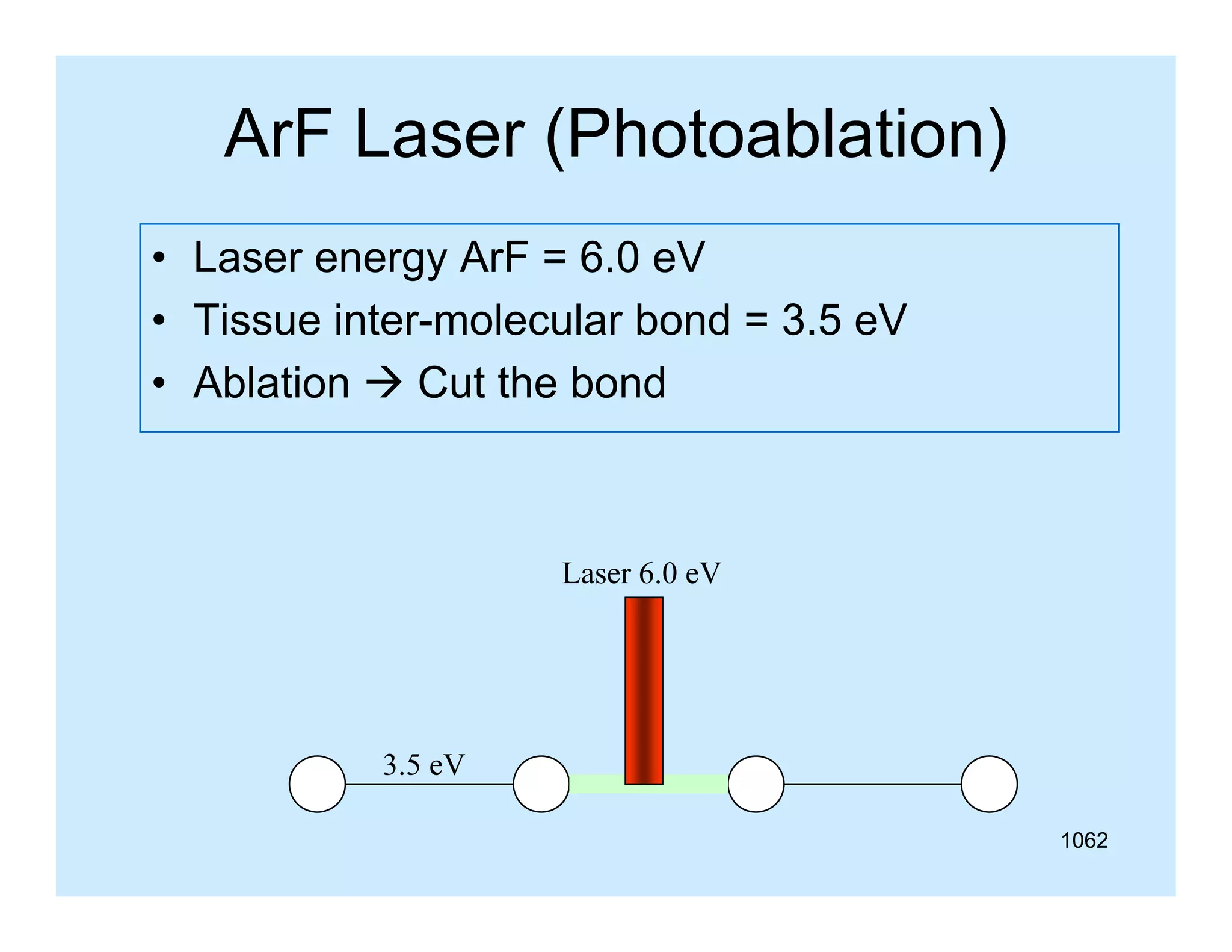 ArF Laser (Photoablation)
• Laser energy ArF = 6.0 eV
• Tissue inter-molecular bond = 3.5 eV
• Ablation  Cut the bond

Laser 6.0 eV

3.5 eV
1062

 