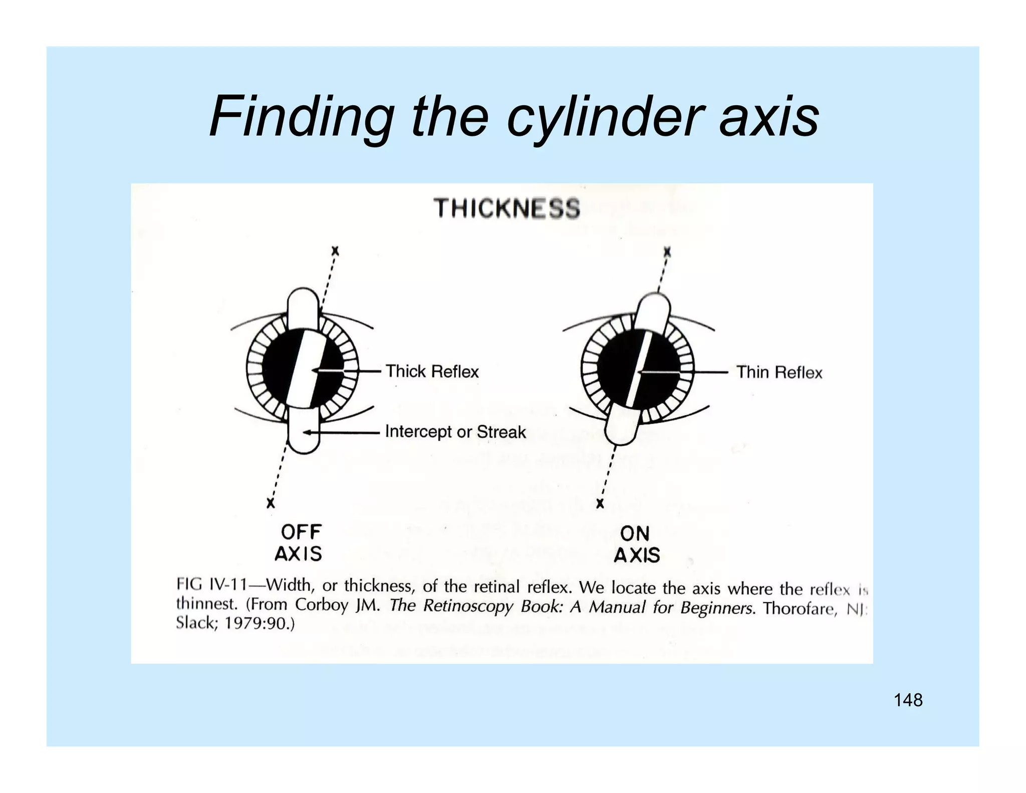 Finding the cylinder axis
g
y

148

 