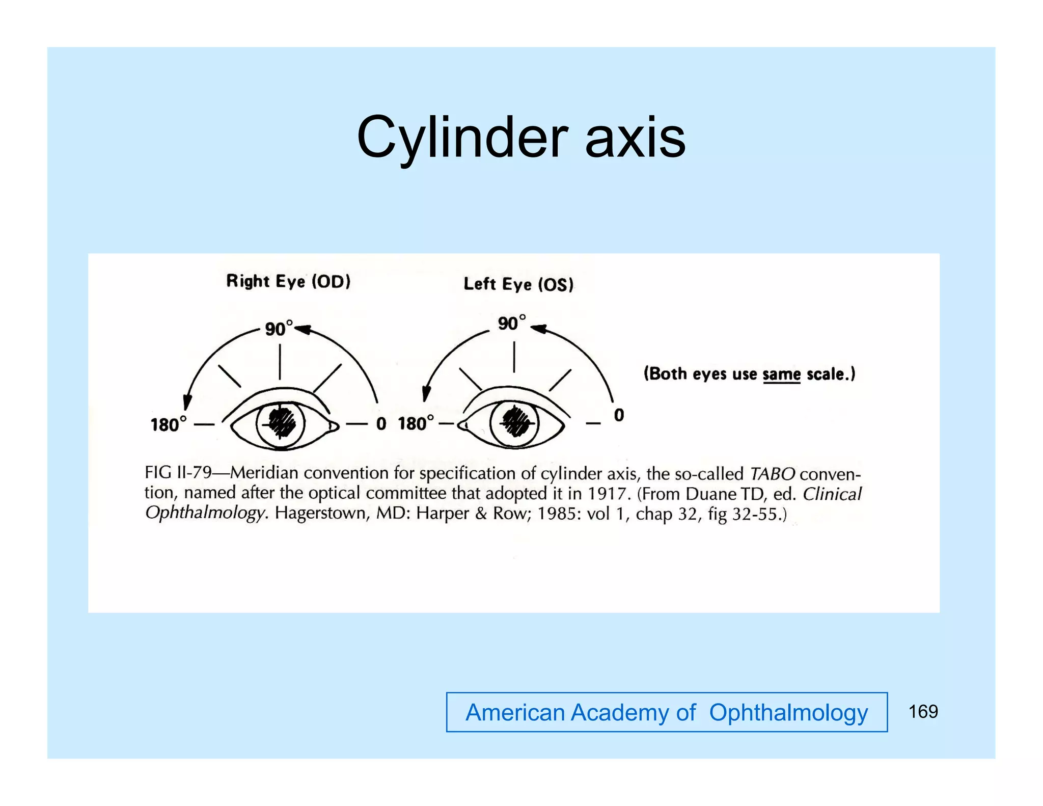 Cylinder axis

American Academy of Ophthalmology

169

 
