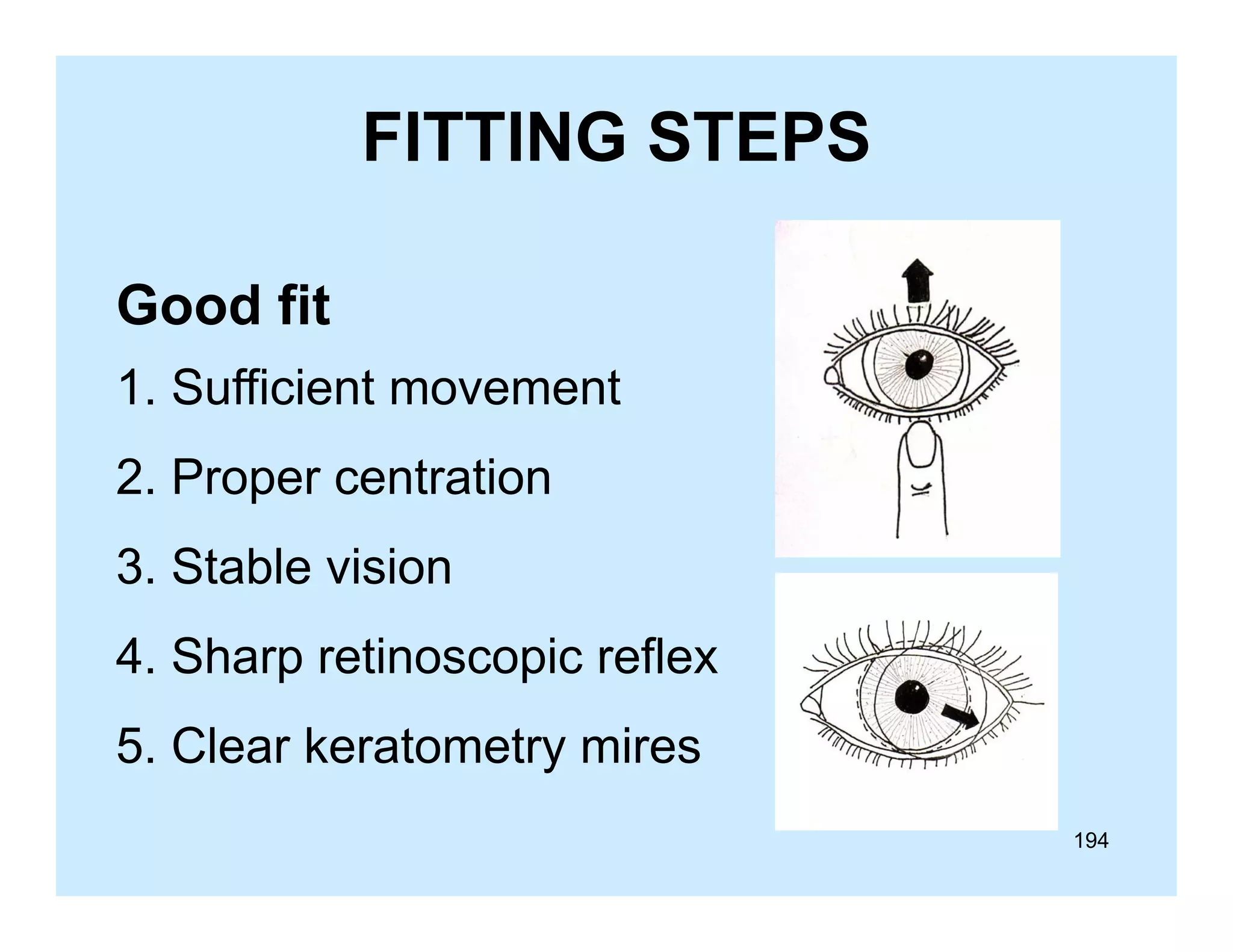 FITTING STEPS
Good fit
1. Sufficient movement
2. Proper centration
3. Stable vision
4.
4 Sharp retinoscopic reflex
5. Clear keratometry mires
194

 