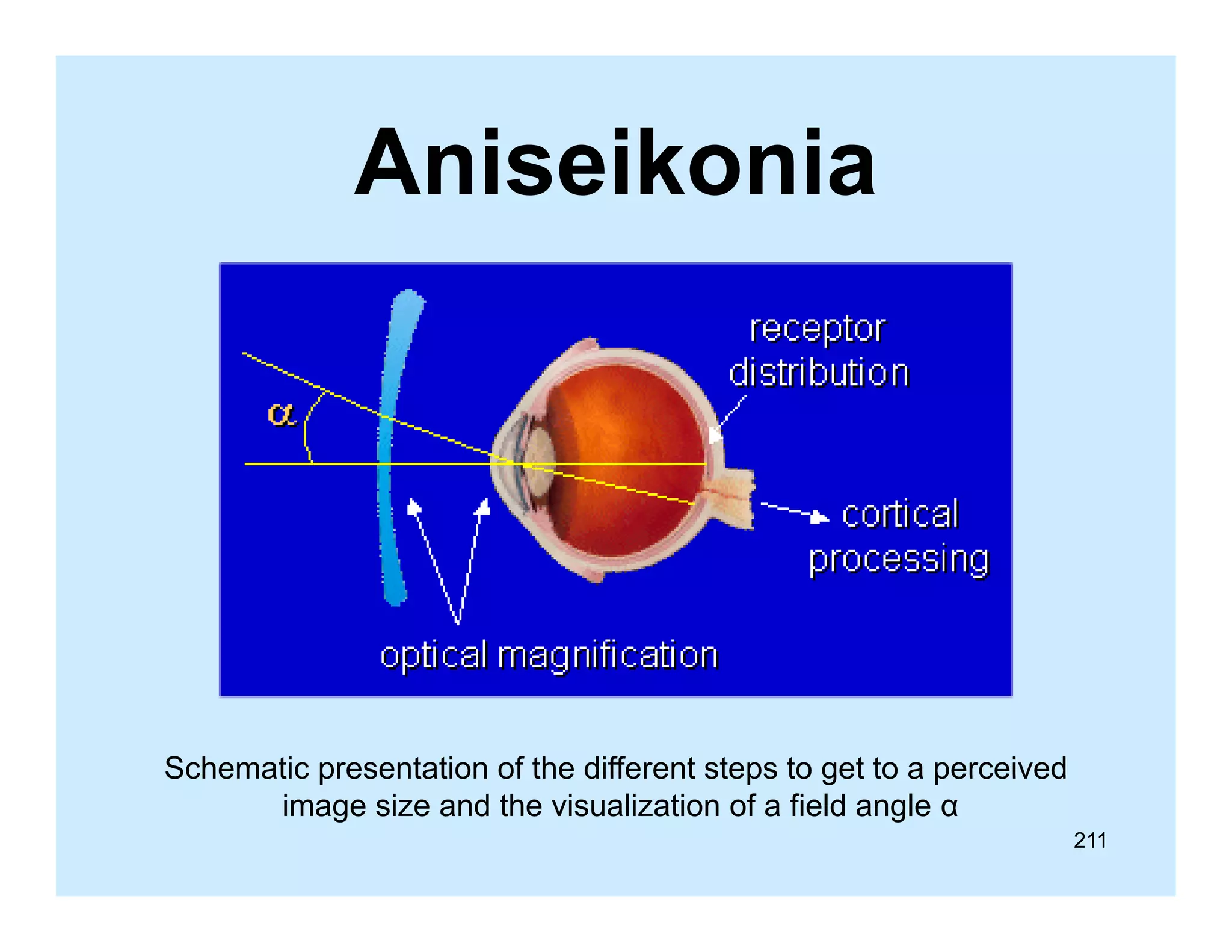 Aniseikonia

Schematic presentation of the different steps to get to a perceived
image size and the visualization of a field angle α
211

 