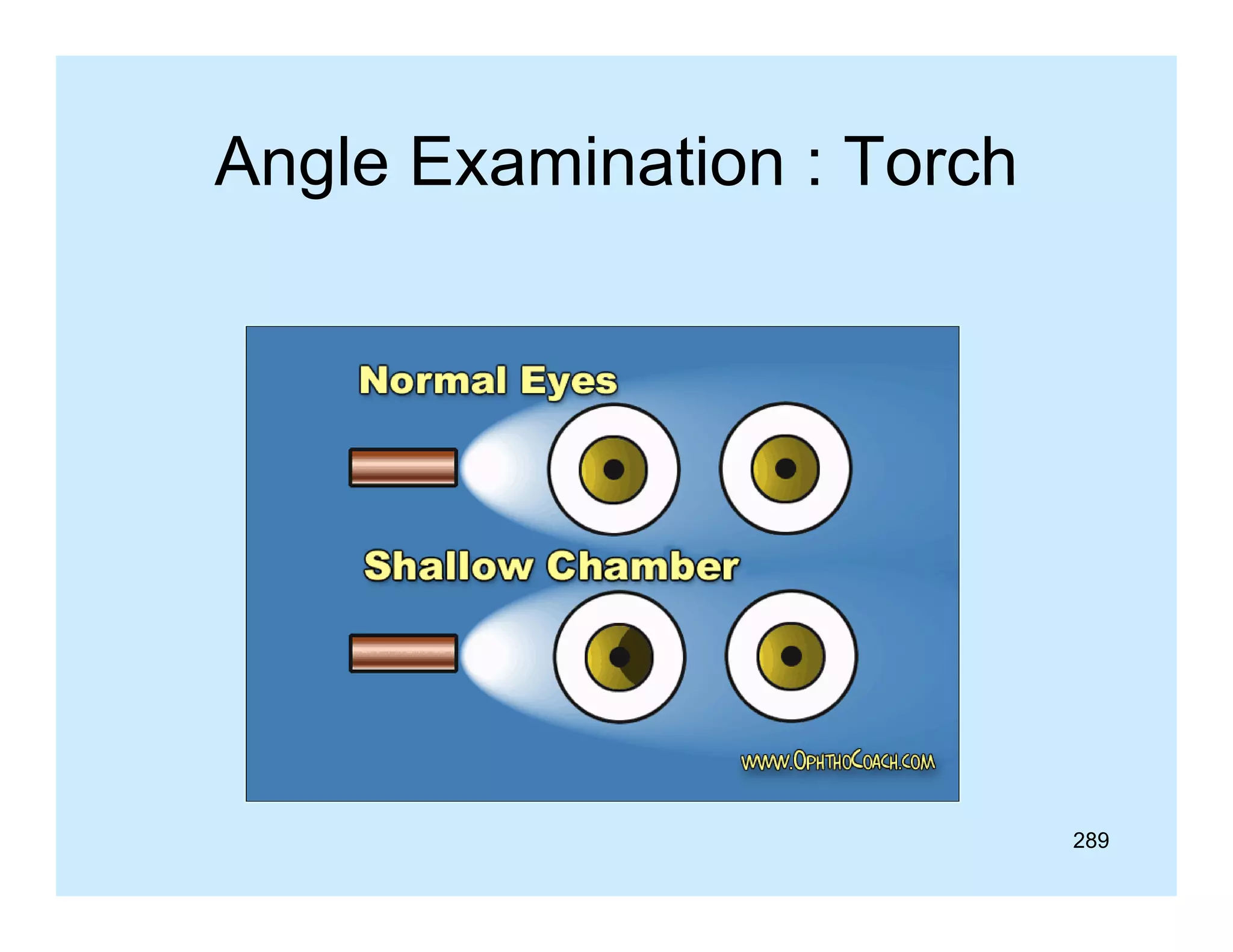 Angle Examination : Torch

289

 