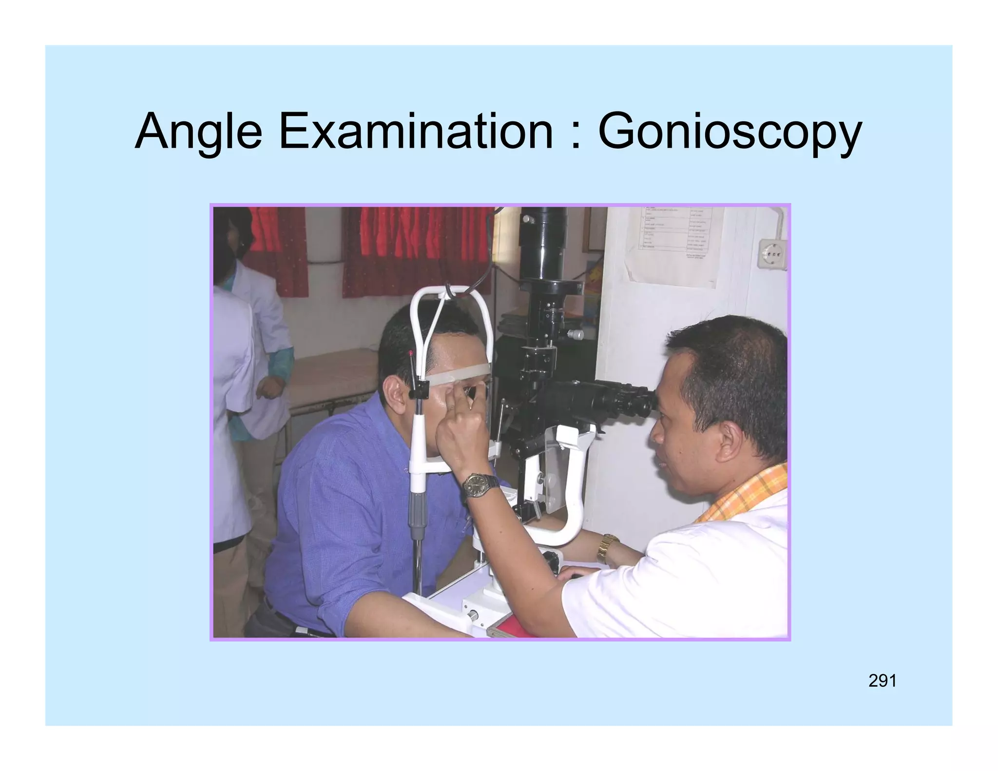 Angle Examination : Gonioscopy

291

 