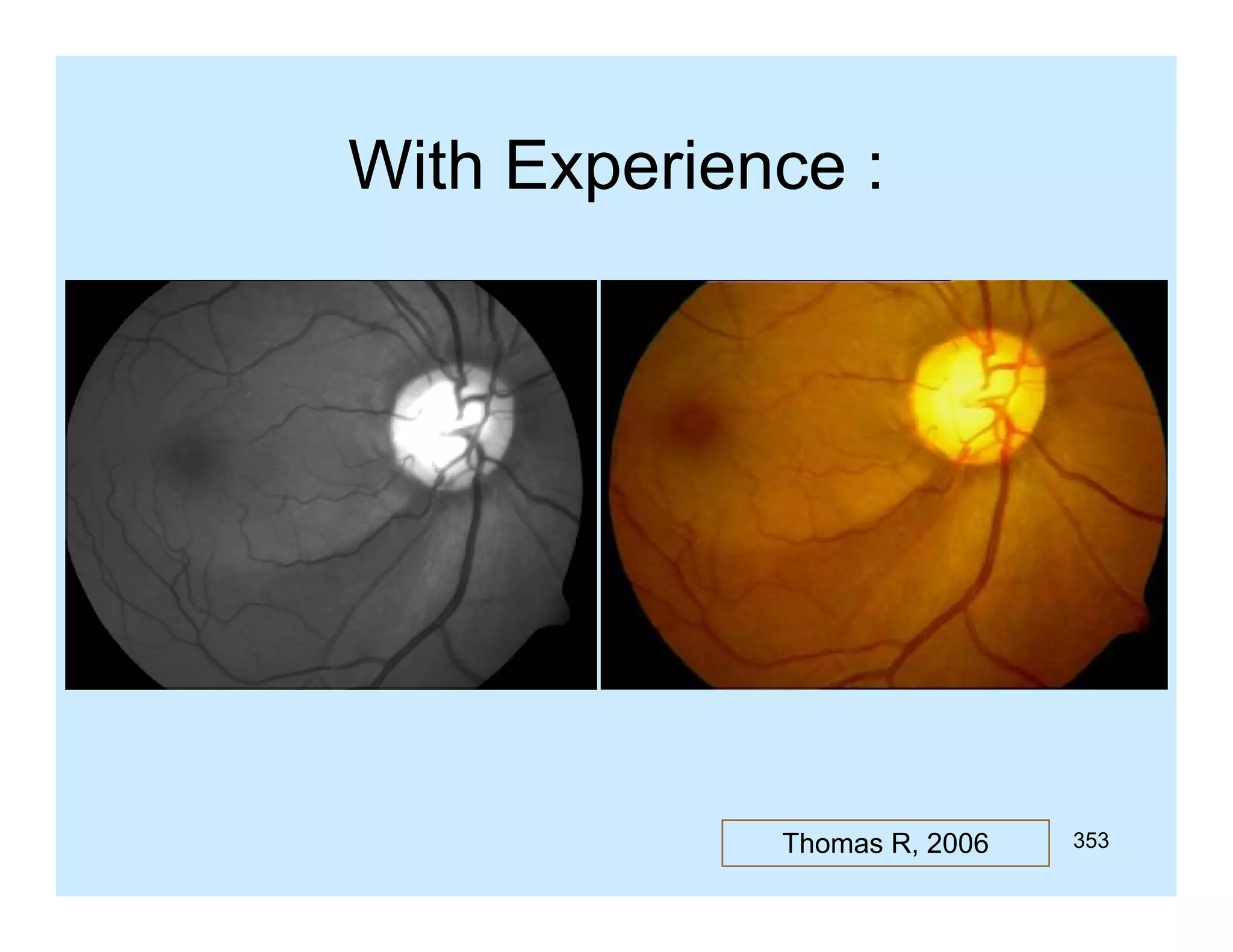 With Experience :

Thomas R, 2006

353

 