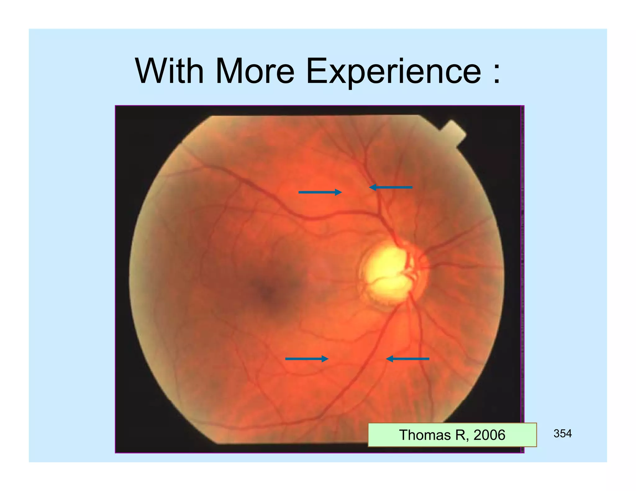 With More Experience :

Thomas R, 2006

354

 