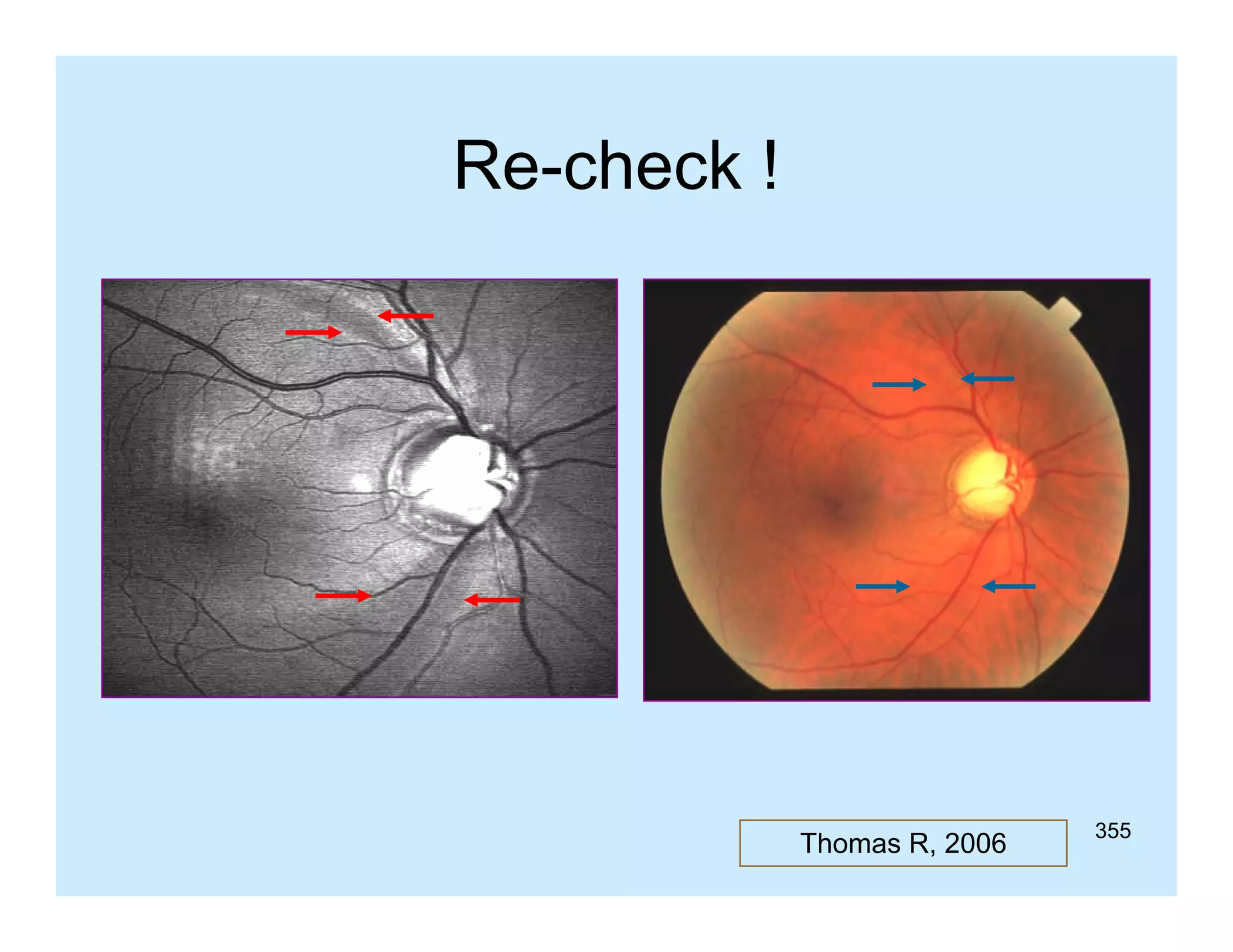 Re check
Re-check !

Thomas R, 2006

355

 