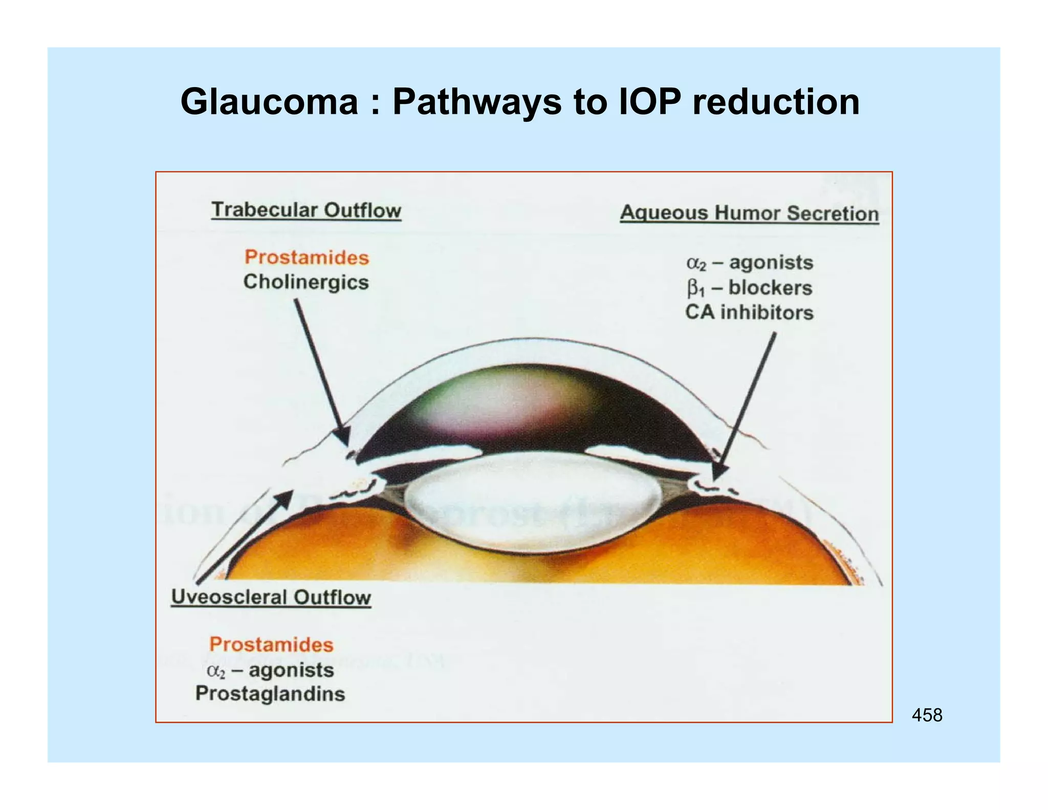 Glaucoma : Pathways to IOP reduction

458

 
