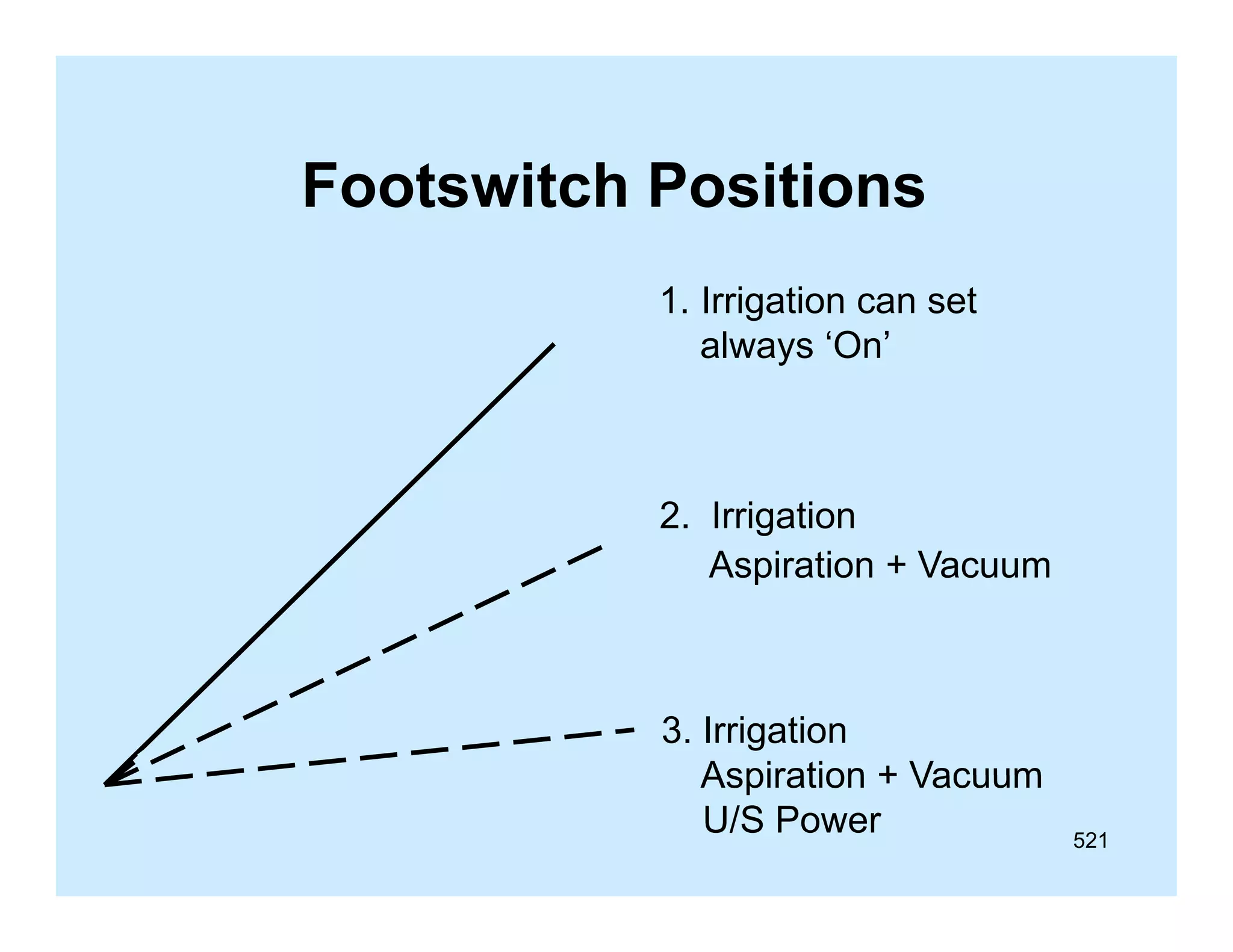 Footswitch Positions
1.
1 Irrigation can set
always ‘On’

2. Irrigation
g
Aspiration + Vacuum

3. Irrigation
Aspiration + Vacuum
U/S Power

521

 