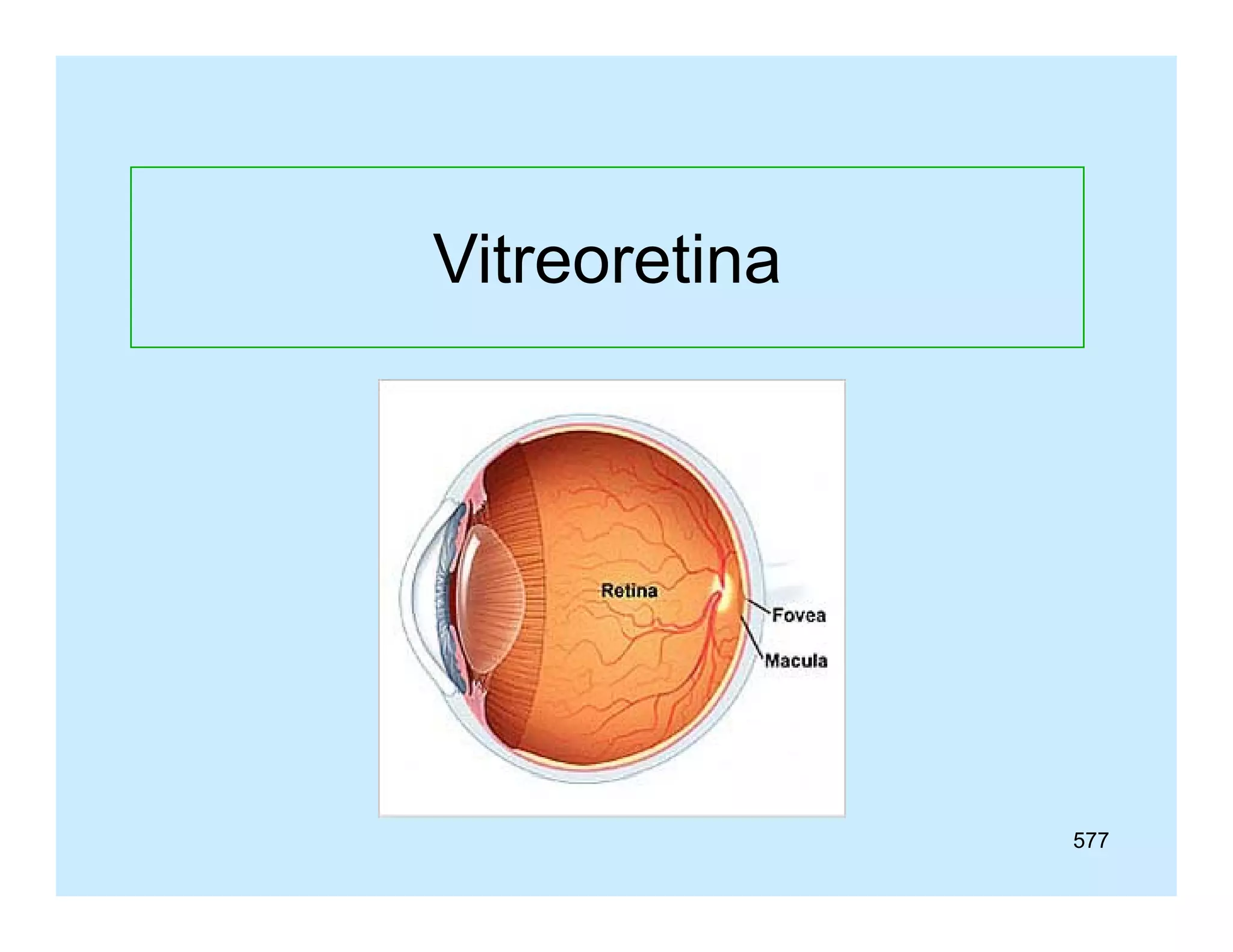 Vitreoretina

577

 